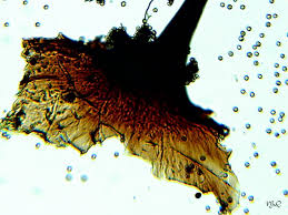 Attēlu rezultāti vaicājumam “Lamproderma echinosporum spores”