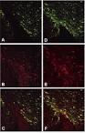 Expression of receptors for insulin and leptin in the ventral ... 