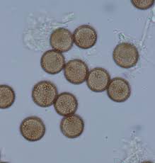 Attēlu rezultāti vaicājumam “Physarum flavicomum stalked”