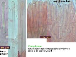 Attēlu rezultāti vaicājumam “Mollisia amenticola”