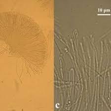 Attēlu rezultāti vaicājumam “Vibrissea decolorans”