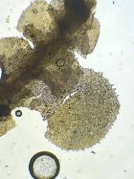 Attēlu rezultāti vaicājumam “Scapania nemorea”