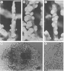 Attēlu rezultāti vaicājumam “Biatoropsis usnearum”