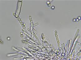 Attēlu rezultāti vaicājumam “Ombrophila violacea spores”