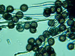 Attēlu rezultāti vaicājumam “Diderma cingulatum spores”