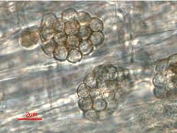 Attēlu rezultāti vaicājumam “Badhamiopsis scripta spores”