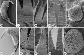 Attēlu rezultāti vaicājumam “Dicranella heteromalla sporophyte”