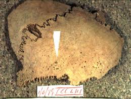 Attēlu rezultāti vaicājumam “Cribraria piriformis stalked”