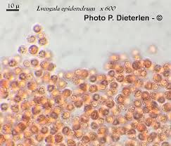 Attēlu rezultāti vaicājumam “Lycogala confusum spores”