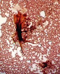 Attēlu rezultāti vaicājumam “Lamproderma pseudomaculatum”