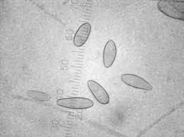 Attēlu rezultāti vaicājumam “Lachnellula willkommii”