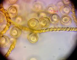 Attēlu rezultāti vaicājumam “Trichia longipalpis spores”