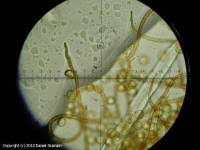 Attēlu rezultāti vaicājumam “Trichia botrytis var. cerifera spores”