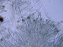 Attēlu rezultāti vaicājumam “Hymenoscyphus imberbis”