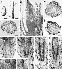 Attēlu rezultāti vaicājumam “Acaulon muticum sporophyte”