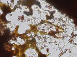 Attēlu rezultāti vaicājumam “Willkommlangea reticulata spores”