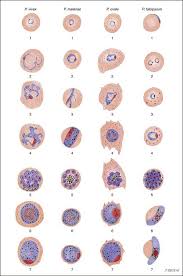 Attēlu rezultāti vaicājumam “Enteridium variabile plasmodium”