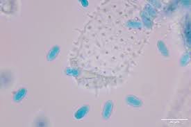 Attēlu rezultāti vaicājumam “Ceratiomyxa morchella spores”