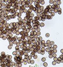 Attēlu rezultāti vaicājumam “Physarum murinum spores”