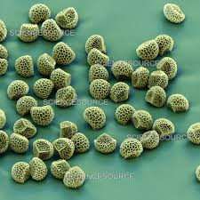 Attēlu rezultāti vaicājumam “Lignydium muscorum spores”