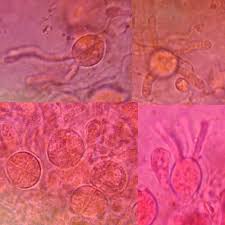 Attēlu rezultāti vaicājumam “Tremella mesenterica”
