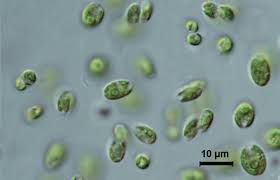 Attēlu rezultāti vaicājumam “Licea chelonoides spores”