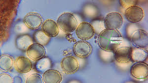 Attēlu rezultāti vaicājumam “Lycogala cf. oleocrystalliferum macro”