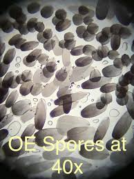Attēlu rezultāti vaicājumam “Oligonema persimile spores”