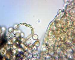 Attēlu rezultāti vaicājumam “Arcyria cinerea spores”