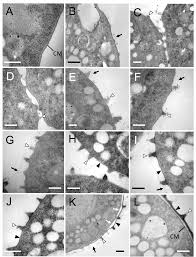 Attēlu rezultāti vaicājumam “Trichia alpina spores”