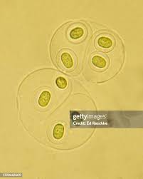 Attēlu rezultāti vaicājumam “Gloeocapsa rupestris”
