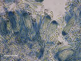 Attēlu rezultāti vaicājumam “Cliostomum corrugatum”