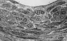 Architecture of the Vessel Wall - Comprehensive Physiology