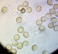 Attēlu rezultāti vaicājumam “Reticularia jurana”