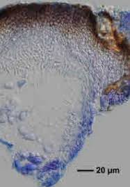 Attēlu rezultāti vaicājumam “Verrucaria hydrela”