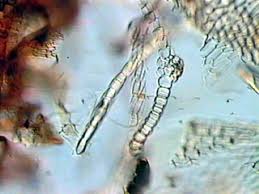 Attēlu rezultāti vaicājumam “Bryum pallescens”