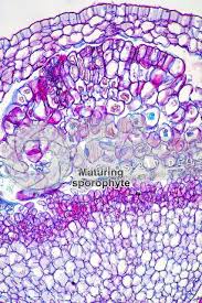 Attēlu rezultāti vaicājumam “Sphagnum sporophyte”