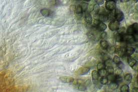 Attēlu rezultāti vaicājumam “Calicium viride”