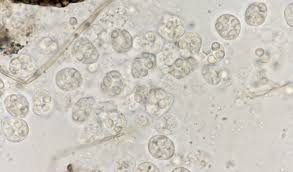 Attēlu rezultāti vaicājumam “Dianema nivale spores”