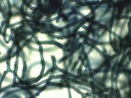 Attēlu rezultāti vaicājumam “Heterotrichia obvelata (syn. Arcyria obvelata) spores”