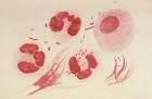 File:<b>Neisseria gonorrhoeae</b>