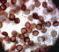 Attēlu rezultāti vaicājumam “Diderma radiatum plasmodium”