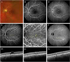 「pvAj[MjA」の画像検索結果