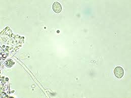 Attēlu rezultāti vaicājumam “Corticium roseum”