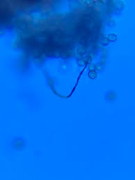 Attēlu rezultāti vaicājumam “Enerthenema papillatum”