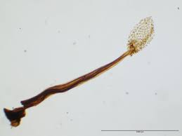 Attēlu rezultāti vaicājumam “Physarum bryocorticola spores”