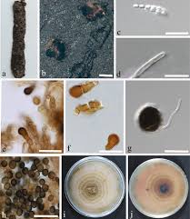 Attēlu rezultāti vaicājumam “Rosellinia desmazieri spores”