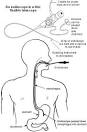 An endoscope is a thin,