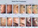 Body Mind Spirit Miami Massage Therapy, Acupuncture, full body ...
