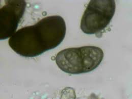 Attēlu rezultāti vaicājumam “Anaptychia ciliaris”